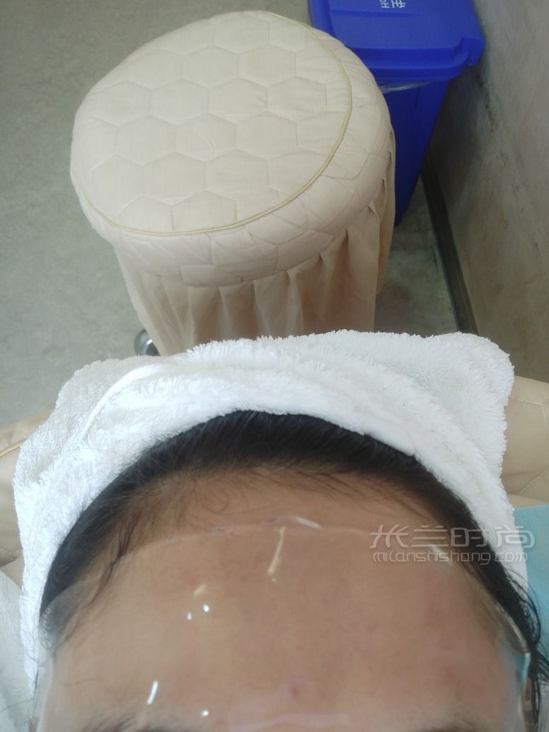 分享我的第三次皮秒美國(guó)賽諾秀 首先告訴大家很疼很疼_2